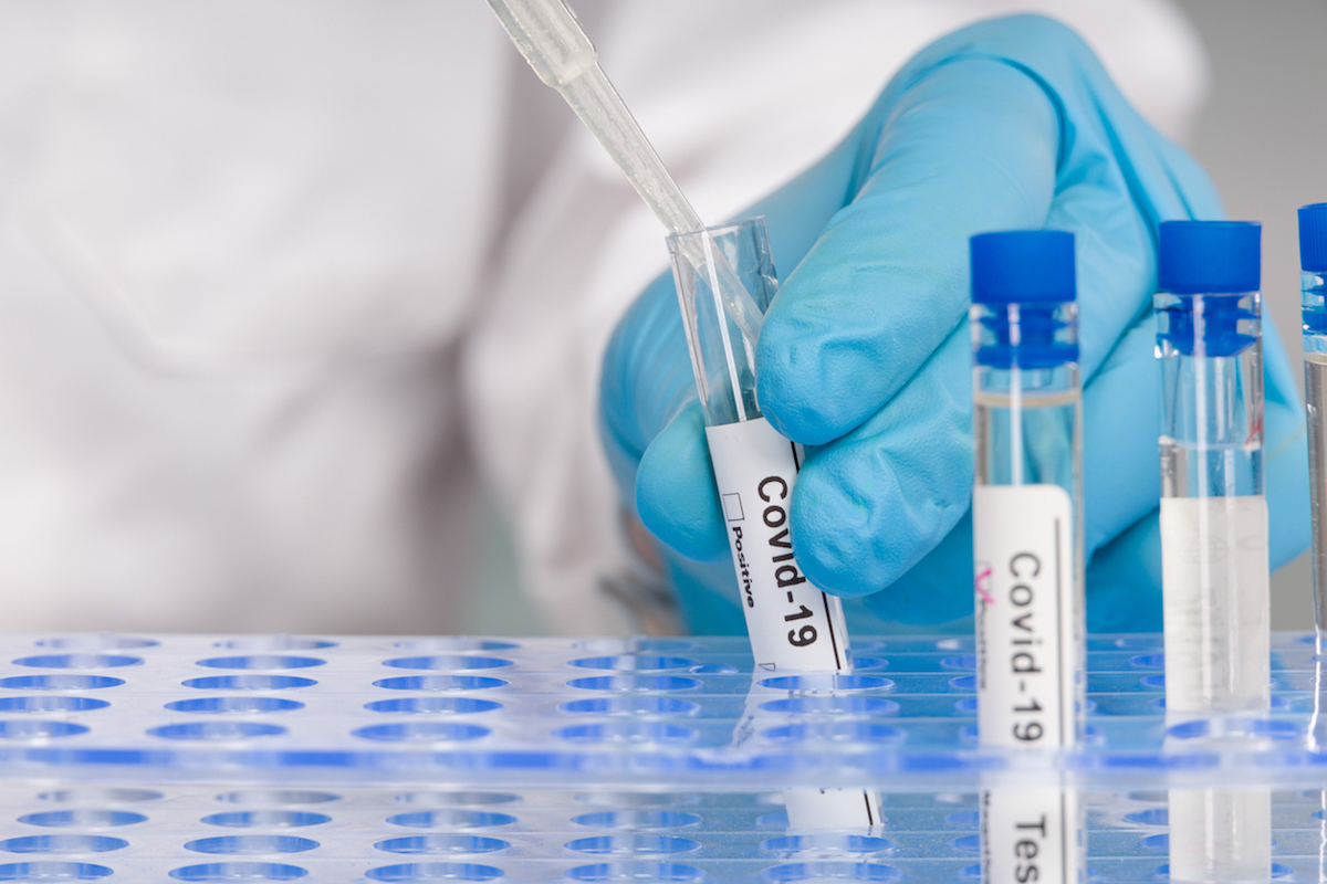 Hand In Blue Gloves Working With Test Tubes At Virus Analysis In A Medical Lab